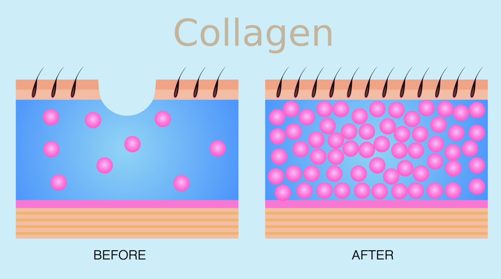 Collagen.jpg